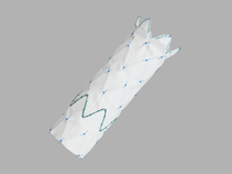 Zenith Alpha™ Thoracic Endovascular Graft Distal Extension